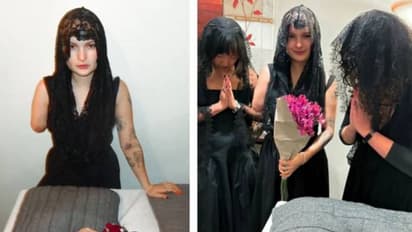 എനിക്കുവേണ്ടി ഏറ്റവും ത്യാ​ഗം ചെയ്തത് നീയാണ്, മുറിച്ചുകളഞ്ഞ കൈക്ക് വികാരനിർഭരമായ യാത്രയയപ്പ് നൽകി യുവതി