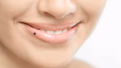 mole on lip