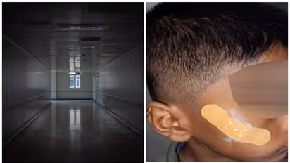 7 വയസുകാരന്റെ മുറിവിന് തുന്നലിടുന്നതിന് പകരം ഫെവിക്വിക്ക് ഉപയോഗിച്ച നഴ്സിനെ സസ്പെന്റ് ചെയ്ത് കർണാടക സർക്കാർ