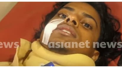 'കവിളില്‍ താക്കോൽ കൊണ്ട് കുത്തി, പല്ലുകള്‍ തകര്‍ന്നു'; ഇൻസ്റ്റ പോസ്റ്റിന്റെ പേരിൽ വിദ്യാർത്ഥിക്ക് ക്രൂരമര്‍ദനം