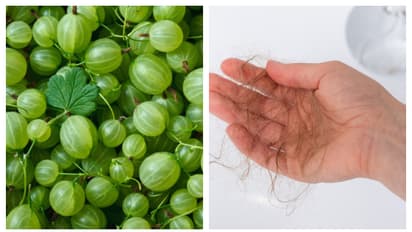 'എവിടെ നോക്കിയാലും മുടി തന്നെ, ഇനിയെന്ത് ചെയ്യും'? വീട്ടിൽ നെല്ലിക്ക ഉണ്ടോ? എന്നാൽ എടുത്ത് ചാമ്പിക്കോ