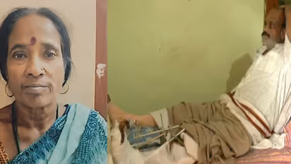 '30 വർഷം മുൻപ് പ്രേമിച്ച് വിവാഹിതരായി', ഭർത്താവിന്റെ കാല് അടിച്ചൊടിക്കാൻ ക്വട്ടേഷൻ, 61കാരി അറസ്റ്റിൽ