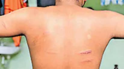 മരണ വീട്ടിൽ സംഘർഷം അറിഞ്ഞെത്തി, യുവാവിനെ വളഞ്ഞിട്ട് തല്ലി പൊലീസ്, താടിയെല്ലിനടക്കം പൊട്ടലെന്ന് പരാതി