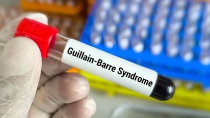 Mumbai records first Guillain-Barre Syndrome death as 53-year-old man succumbs to illness