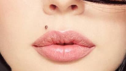 mole on lip