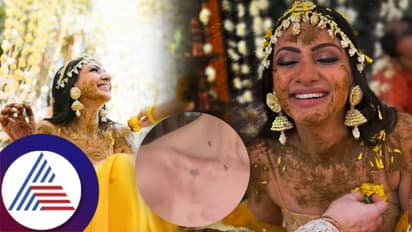 ಹಳದಿ ಶಾಸ್ತ್ರದ ನಂತರ ಚರ್ಮದ ಅಲರ್ಜಿಗೆ ಒಳಗಾದ ಪ್ರಿಯಾಂಕಾ ಚೋಪ್ರಾ ಅತ್ತಿಗೆ ನೀಲಂ!