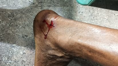 തുണി അലക്കാന് പുത്തനാറ്റിലിറങ്ങി; കാല് കടിച്ച് വലിച്ച് നീര്നായ, വ്യാപക പരാതിയുമായി നാട്ടുകാര്