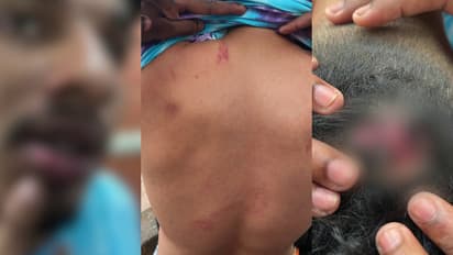 ഹോം സ്റ്റേ അടിച്ച് പൊളിച്ച് ഒന്നാം വർഷ വിദ്യാർത്ഥിക്ക് ക്രൂരമർദനം ; സീനിയർ നിയമ വിദ്യാർത്ഥികൾക്കെതിരെ കേസ്