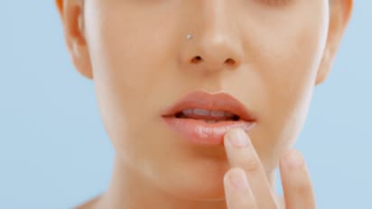 ചുണ്ടുകൾ വരണ്ട് പൊട്ടുന്നുണ്ടോ? തടയാൻ ചെയ്യേണ്ട കാര്യങ്ങള്‍