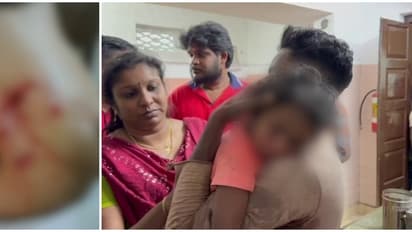  മലപ്പുറത്ത് അമ്മയുടെ തോളിൽ കിടന്ന കുഞ്ഞ് അടക്കം 7 പേരെ കടിച്ച നായ ചത്ത നിലയിൽ