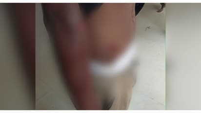 കാട്ടുപന്നി കുറുകെചാടി ബൈക്ക് നിയന്ത്രണം വിട്ട് മറിഞ്ഞ് അപകടം; 2 പേർക്ക് പരുക്കേറ്റു