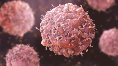 Health Tips: ക്യാന്സര് സാധ്യത കുറയ്ക്കാന് സഹായിക്കുന്ന ഭക്ഷണങ്ങള്