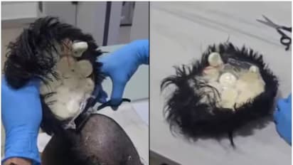 എയർപോർട്ടിലെ പരിശോധനയിൽ എല്ലാം ഒ.കെയായിരുന്നെങ്കിലും മുടിയിൽ സംശയം; വിഗ് പുറത്തെടുത്തപ്പോൾ കിട്ടിയത് കൊക്കൈൻ