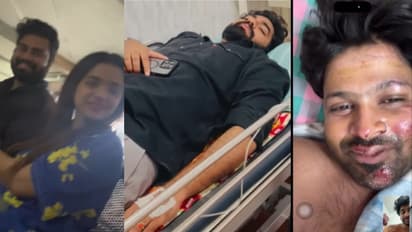 തകൃതിയായ കല്യാണമേളം, പിന്നാലെ ആശുപത്രിയിലായി റോബിൻ; സുഹൃത്തുക്കള്‍ക്ക് പരിക്ക്, ചോദ്യങ്ങളുമായി ആരാധകർ 