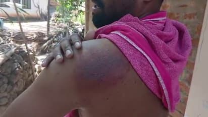 കൊടുംചൂട്; പാലക്കാട് യുവാവിന് സൂര്യാഘാതമേറ്റു 