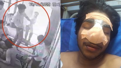 ഒറ്റപ്പാലത്തെ സ്വകാര്യ ഐടിഐയിൽ സഹപാഠിയുടെ മർദ്ദനമേറ്റ് വിദ്യാർത്ഥിയുടെ മൂക്കിൻ്റെ എല്ല് പൊട്ടി; പൊലീസ് കേസ്