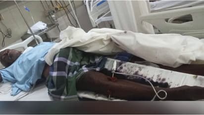 സംസ്ഥാനത്ത് ഇന്ന് വീണ്ടും കാട്ടുപന്നി ആക്രമണം; എഴുപതുകാരൻ്റെ കാലൊടിഞ്ഞു, ആക്രമണം കൃഷിയിടത്തിൽ എത്തിയപ്പോൾ