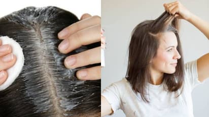 Home Remedies For Smelly hair and Scalp