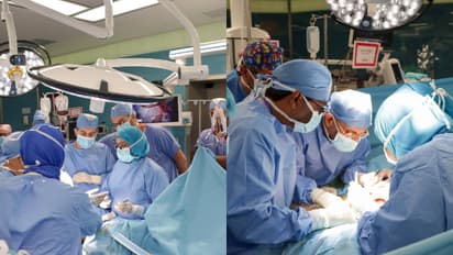 19 മണിക്കൂർ നീണ്ടുനിന്ന ശസ്ത്രക്രിയ; സയാമീസ് ഇരട്ടകളെ വേർപെടുത്തി