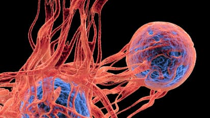 Does asprin prevent cancer from spreading? Scientists uncover the mechanism