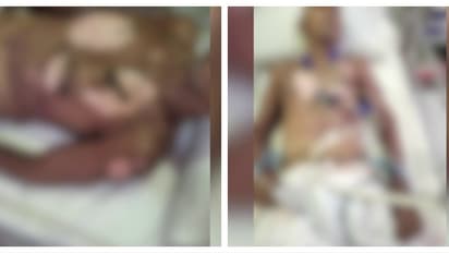 കാസർകോട് ബന്ധുവീട്ടിലേക്ക് നടന്നുപോയ വയോധികൻ സൂര്യാഘാതമേറ്റ്  മരിച്ചു