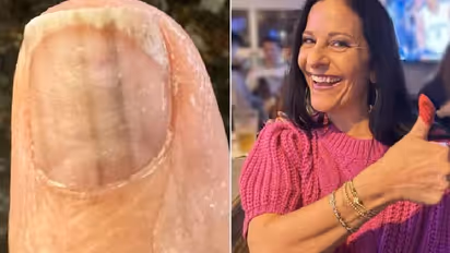 നഖത്തിന് മുകളിൽ രണ്ട് കറുത്ത പാടുകൾ, ആദ്യം ​ഗൗനിച്ചില്ല, ഒരുമാസം കഴിഞ്ഞിട്ടും പോയില്ല, ടെസ്റ്റ്, കണ്ടെത്തിയത് 