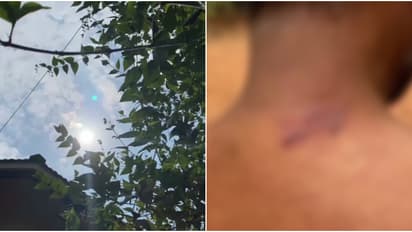 പൊതുജനങ്ങൾക്ക് മുന്നറിയിപ്പ്, കനത്ത ചൂടും അപായകരമായ അളവിൽ അൾട്രാവയലറ്റ് വികിരണത്തിനും സാധ്യത