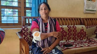 'ആക്രമണ സ്വഭാവം കാട്ടുന്നെന്ന പരാതിയിൽ പൂട്ടിയിടാൻ നിര്ദേശം നൽകി, പാലിച്ചില്ല', വീട്ടമ്മയെ വളർത്തുനായ കടിച്ചു