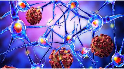 എറണാകുളം കളമശ്ശേരിയിൽ കുട്ടികൾക്ക് വൈറൽ മെനിഞ്ചൈറ്റിസ്; സ്കൂൾ ഒരാഴ്ചത്തേക്ക് അടച്ചു, 2 പേർ ചികിത്സയിൽ