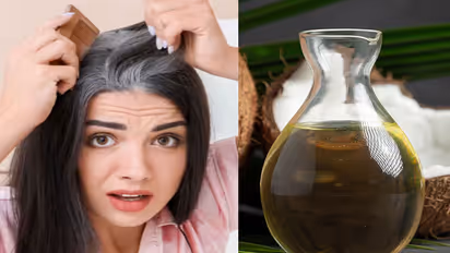 ಸೈಡ್ ಎಫೆಕ್ಟ್ ಇಲ್ಲದೆ ಬಿಳಿ ಕೂದಲನ್ನ ಶಾಶ್ವತವಾಗಿ ಕಪ್ಪಗೆ ಮಾಡೋದು ಹೇಗೆ ಗೊತ್ತಾ?