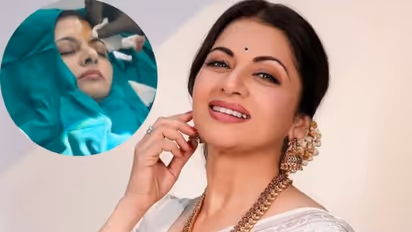 Bhagyashree Suffers Head Injury: Actress undergoes surgery after pickleball injury, receives 13 stitches