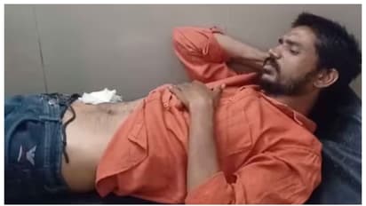 വയറ് വേദന അസഹനീയം, യൂട്യൂബ് നോക്കി സ്വയം ശസ്ത്രക്രിയ നടത്തിയ യുവാവ് ആശുപത്രിയില്‍, 11 തുന്നിക്കെട്ട് 