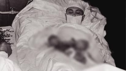 'ഒരു കണ്ണാടിയിലെ പ്രതിബിംബം നോക്കി രാത്രിയിൽ എങ്ങനെ അപ്പൻഡിക്സിൻ്റെ ബേസിൽ തയ്യലിട്ടു'; വൈറലായി കുറിപ്പ് 