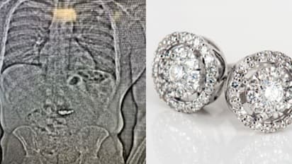 പൊലീസ് സംരക്ഷണയിൽ 32കാരൻ ആശുപത്രിയിൽ കഴിഞ്ഞത് 26 ദിവസം, 6.6 കോടിയുടെ തൊണ്ടിമുതൽ ഒടുവിൽ വീണ്ടെടുത്തു