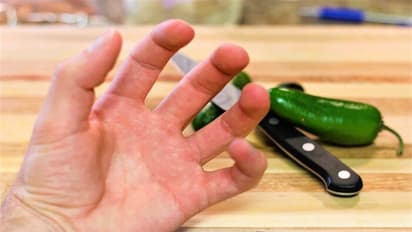 பச்சை மிளகாய் நறுக்கிய பின் கை எரிச்சல் நீங்க சிம்பிள் டிப்ஸ்!