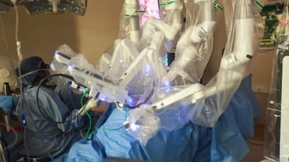 അഭിമാന നേട്ടം; സർക്കാർ മേഖലയിൽ ആദ്യമായി കാൻസറിന് റോബോട്ടിക് പീഡിയാട്രിക് സർജറി, 3 വയസുകാരന് പുതുജീവൻ