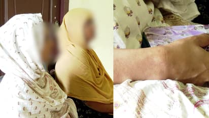 'എന്നെ റൂമിൽ ഭക്ഷണം തരാതെ പൂട്ടിയിട്ടു, കയ്യും കാലും കെട്ടിയിട്ടു'; യുവതിയുടെ ഞെട്ടിക്കുന്ന വെളിപ്പെടുത്തൽ