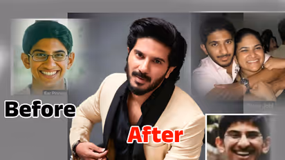 వాటిని ప్లాస్టిక్ సర్జరీ చేయించుకున్న దుల్కర్ సల్మాన్.. సర్జరీకి ముందు ఎలా ఉండేవారో చూడండి!