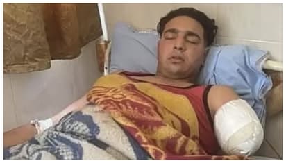 ലൈവ് സര്ക്കസ് പ്രകടനത്തിനിടെ സിംഹത്തിന്റെ അപ്രതീക്ഷിത ആക്രമണം, ഗുരുതര പരിക്കേറ്റ് പരിശീലകൻ, ഇടത് കൈ മുറിച്ചു