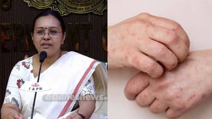 റീയൂണിയന് ദ്വീപുകളില് ചിക്കന്ഗുനിയ വ്യാപനം, കേരളം കരുതിയിരിക്കണം; ആരോഗ്യ മന്ത്രി വീണാ ജോര്ജ്
