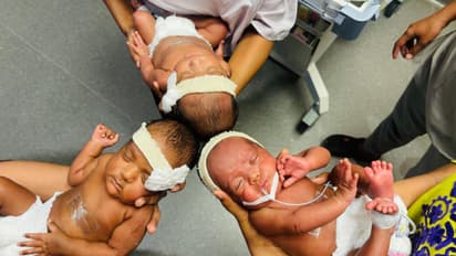 Medical miracle: How India's first 25-week IVF triplets defied all odds to come home healthy (PHOTOS)