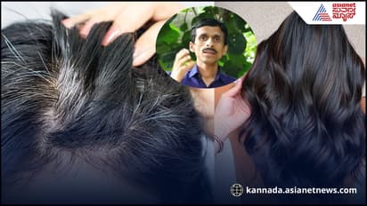 ಎರಡೇ ಎರಡೇ ಪುಡಿ- ಬಿಳಿಗೂದಲು ಫುಲ್​ ಮಾಯ: ಪ್ರಖ್ಯಾತ ಆಯುರ್ವೇದ ವೈದ್ಯರ ಸಲಹೆ ಕೇಳಿ