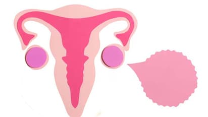 Women health risk: Microplastics found in ovaries; risks and impact explained