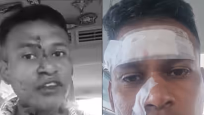 Bengaluru road rage shocker: IAF officer assaulted, shares 'you can see the blood' ordeal (WATCH)