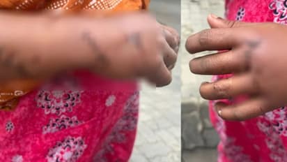 ലഹരി സംഘത്തില്‍ നിന്ന് പിന്‍മാറിയതിന് വധഭീഷണി, പരാതി നല്‍കിയതിന് പിന്നാലെ കോഴിക്കോട് യുവതിക്ക് നേരെ ആക്രമണം