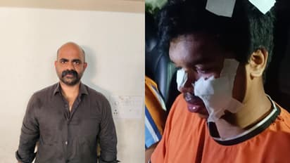 കാറിന്റെ കണ്ണാടി തകര്‍ന്നത് ചോദ്യം ചെയ്തതിന് സഹോദരങ്ങളെ കല്ലുകൊണ്ട് ക്രൂരമായി മര്‍ദ്ദിച്ചു, യുവാവ് പിടിയില്‍