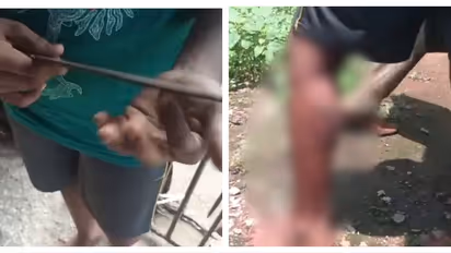 കൂട്ടുകാരുടെ കൂടെ കളിക്കാൻ പോയി, 11കാരനെ ഇരുമ്പ് കമ്പി ചൂടാക്കി പൊള്ളിച്ച് അച്ഛൻ; അറസ്റ്റിൽ