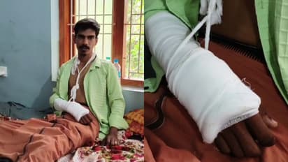 ആറടി താഴ്ചയുള്ള സ്ലാബില്ലാത്ത ഓടയിൽ വീണ് ടാക്സി ഡ്രൈവറുടെ കൈയൊടിഞ്ഞു, ഇടതുകാലിന്‍റെ വിരലുകള്‍ക്ക് പൊട്ടൽ