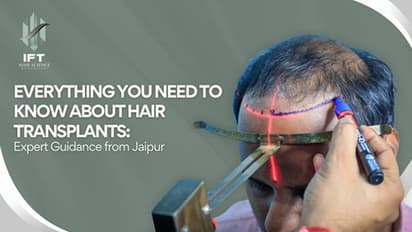 IFT Hair Science: Demystifying Hair Transplants with Expert Insights from Jaipur