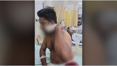 കോഴിക്കോട് പന്നിയങ്കരയിൽ കല്യാണ വീട്ടിൽ മദ്യത്തെ ചൊല്ലി തർക്കം; ഒരാൾക്ക് കുത്തേറ്റു, ആശുപത്രിയിൽ ചികിത്സയിൽ